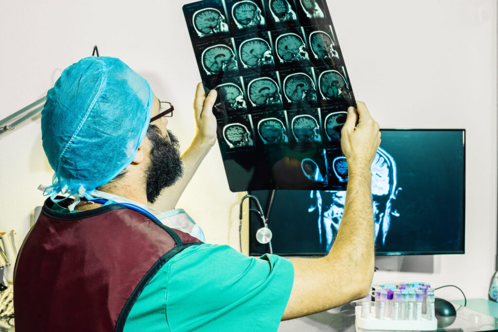 Accidents That Cause Brain Injuries in Las Vegas